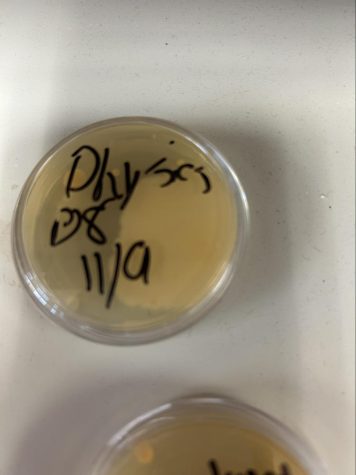 A rather large spot of bacteria growth can be spotted in this Petri dish.